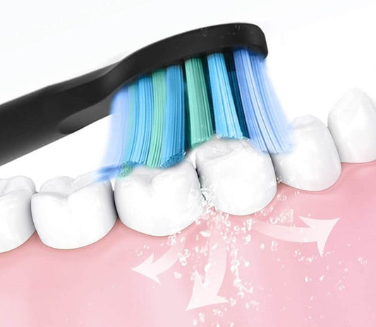 Fairywill - Oplaadbare Sonische Elektrische Tandenborstel