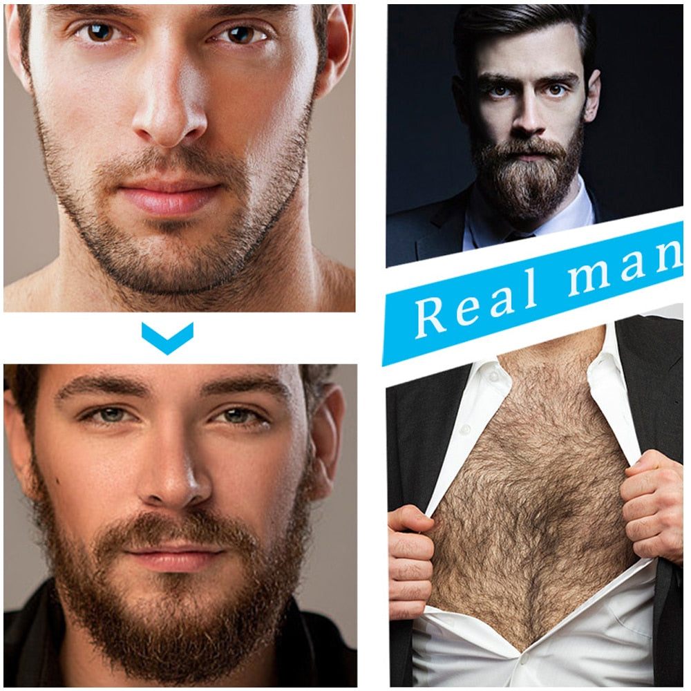 Beard Growth Kit - Professionele Baard Groei Kit