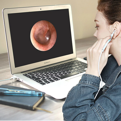 Ear Cleaner | 3- in 1 Oor Schoonmaak Camera