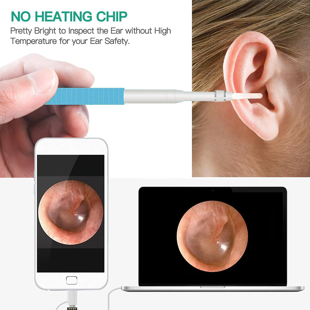 Ear Cleaner | 3- in 1 Oor Schoonmaak Camera