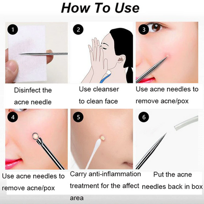 Acne Cleaning Tool | Een zichtbaar stralende huid