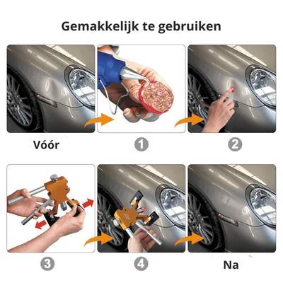 Dentfix Pro™ - Auto Deuk Reparatie Kit