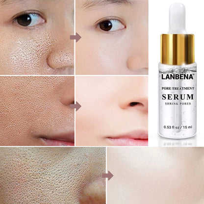 Lanbena Pores Serum™ (1+1 GRATIS)