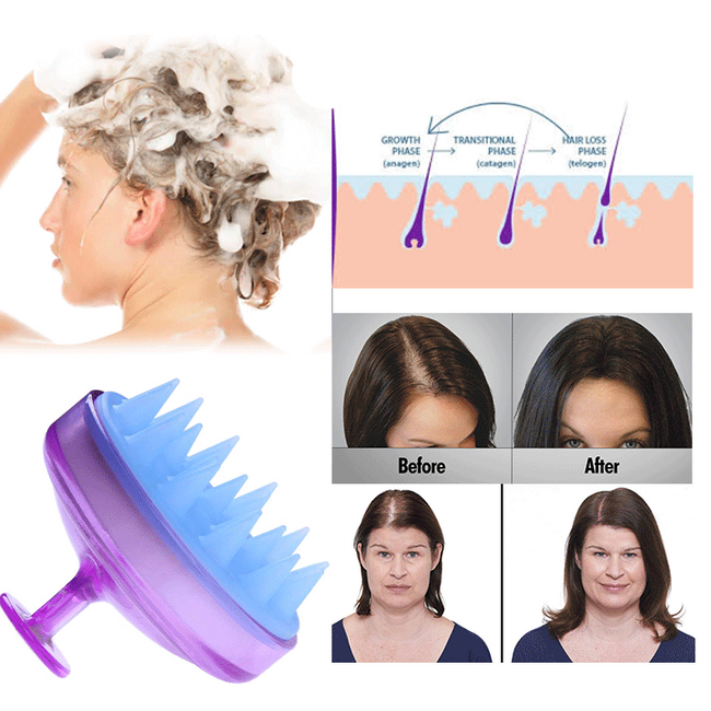 Hoofdhuid Massage Borstel | Scalp Voor Gezond Haar
