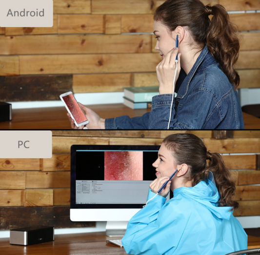 Ear Cleaning Endoscope™
