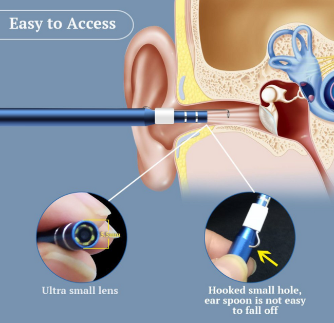 Ear Cleaning Endoscope™