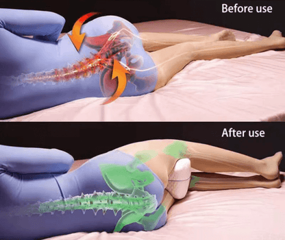 Orthopedisch Been Kussen