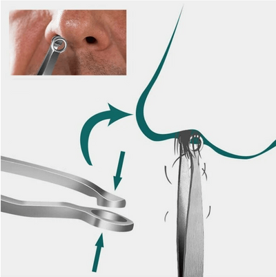 Ear Nose Trimmer | Ontharing Pincet